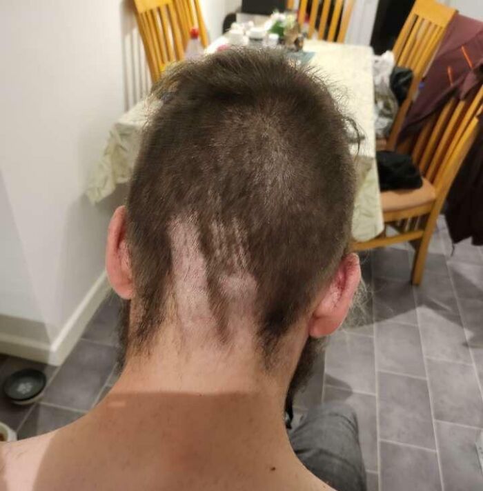 A person with a terrible haircut showing patchy, unevenly shaved hair. A beauty disaster with a funny, terrible result.