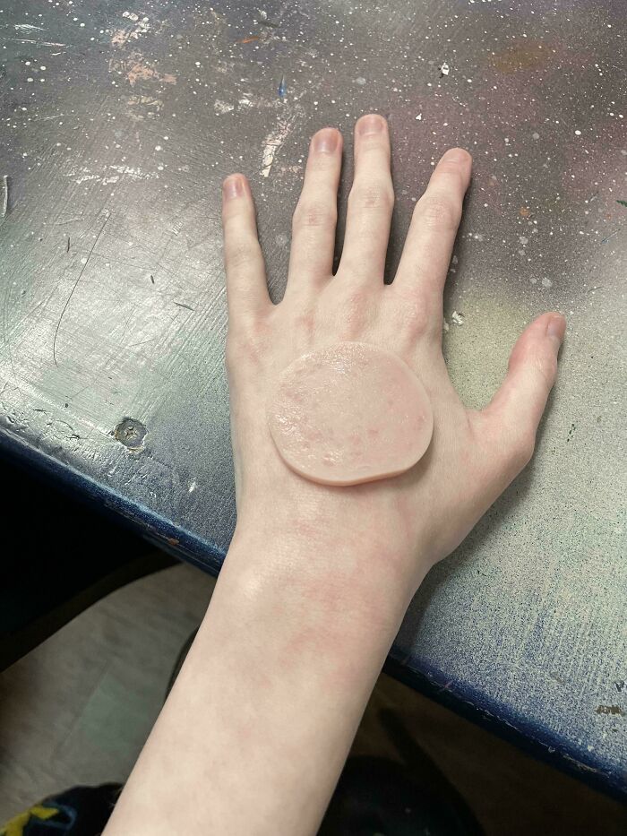 A person's pale hand with a round piece of ham on it, creating an accidental color match on a speckled table, potentially lowering cortisol levels.