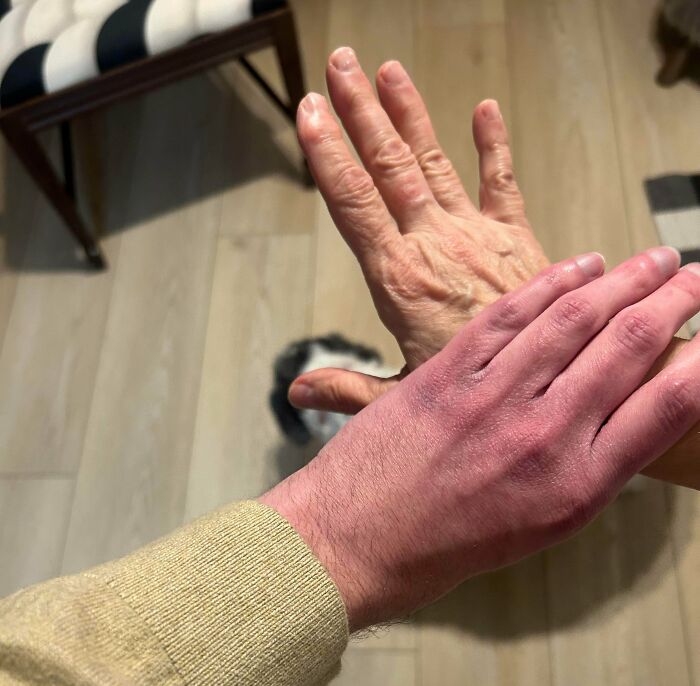 Hands of different ages showing strange skin contrast under indoor light