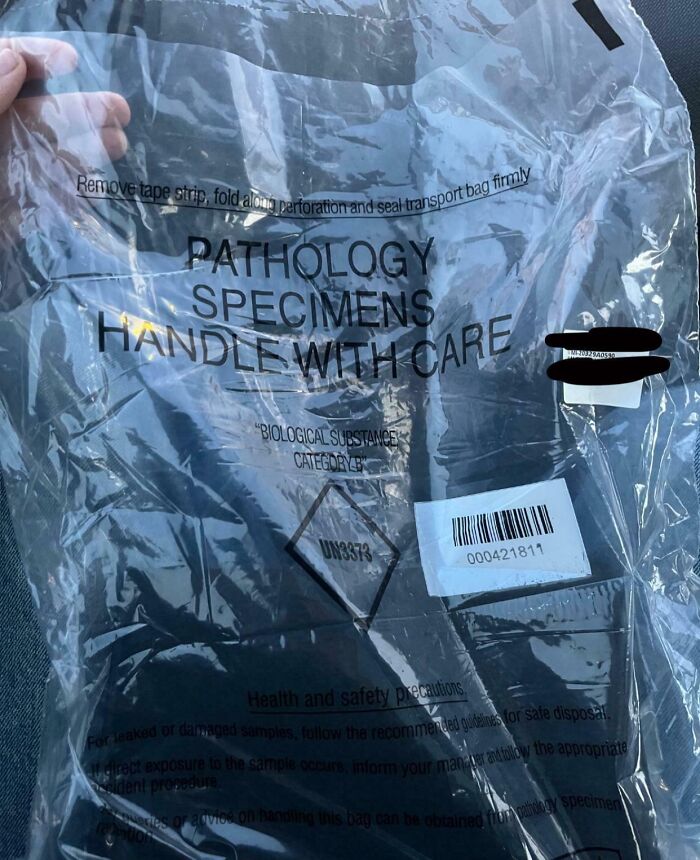 Clear plastic pathology specimen bag with handle with care warning label