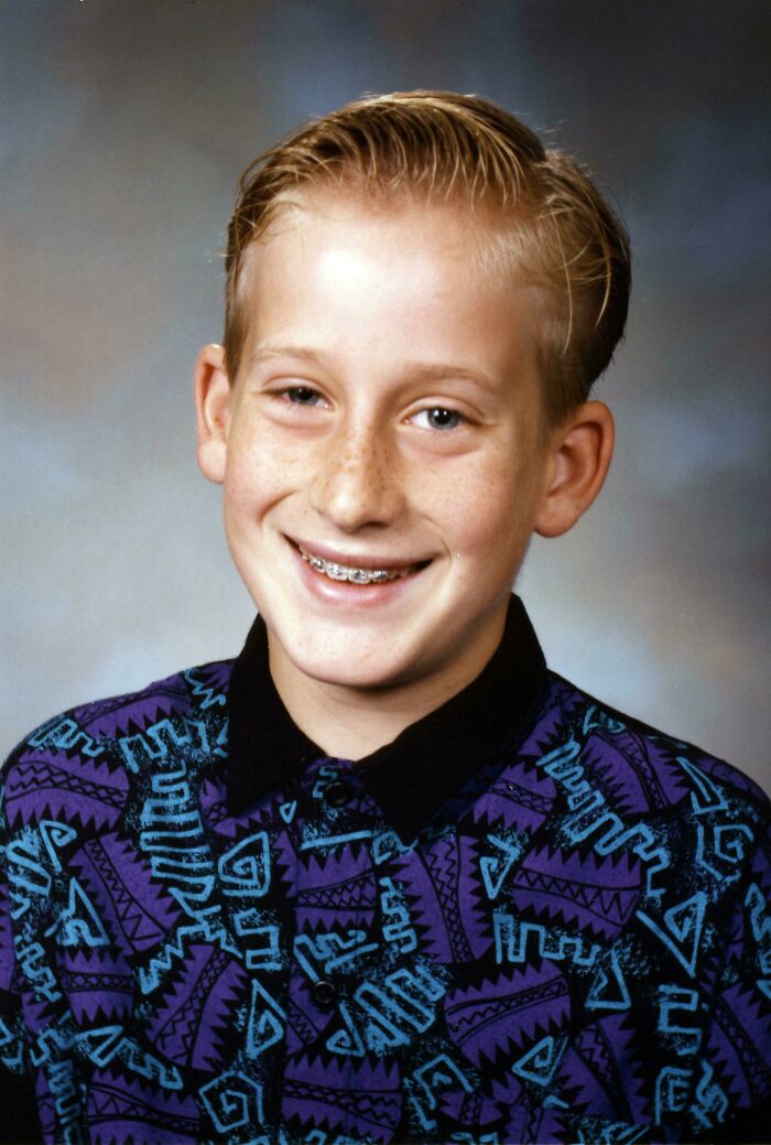 A young boy with braces and a patterned shirt, a typical look for 90s kids.