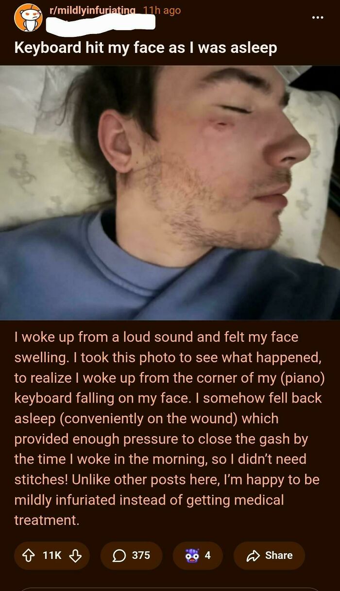 Sleeping person with face injury from keyboard accident