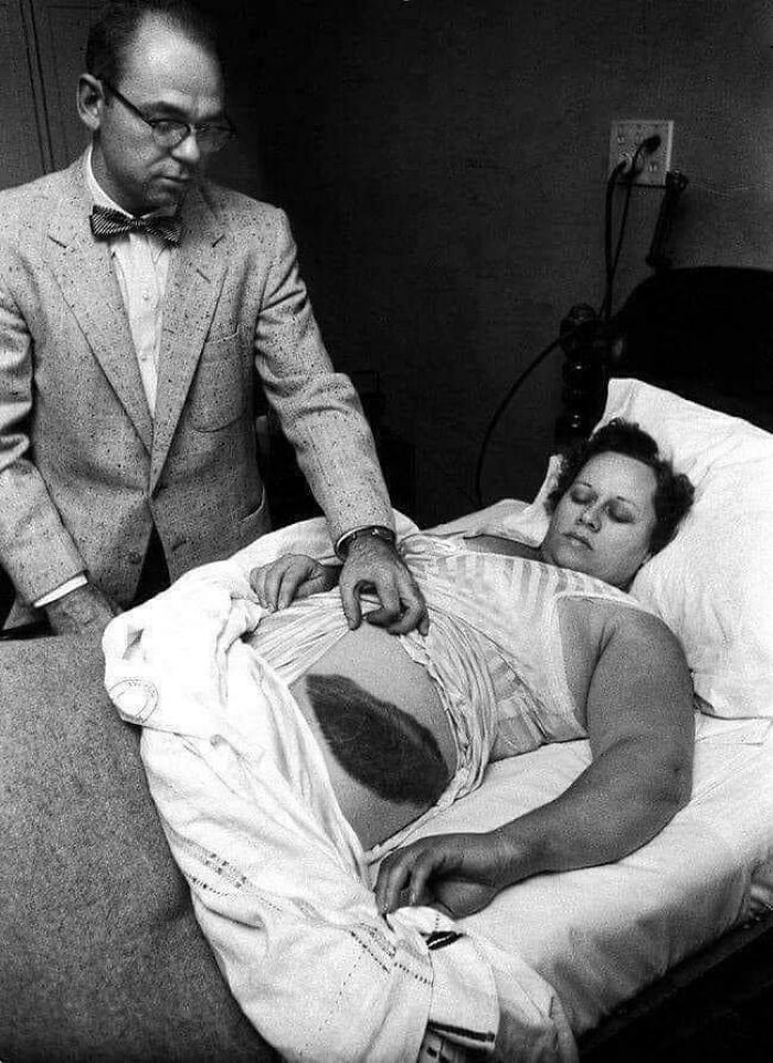 Ann Hodges Is The Only Confirmed Person In History To Have Been Hit By A Meteorite Which Occurred In 1954