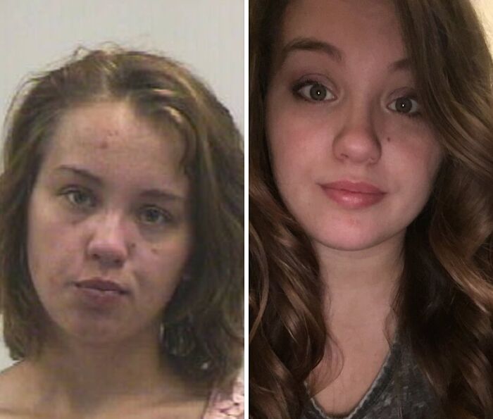 Before and after photos of woman showing impressive recovery and transformation