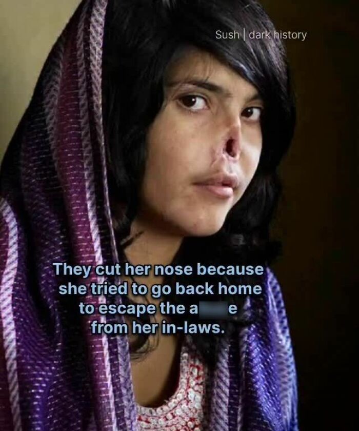 Image of a woman with nose injury and text about a horrific punishment from in-laws