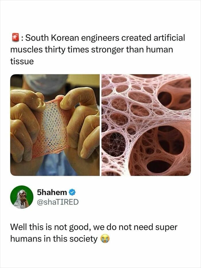 Images of stretchy artificial muscles stronger than human tissue