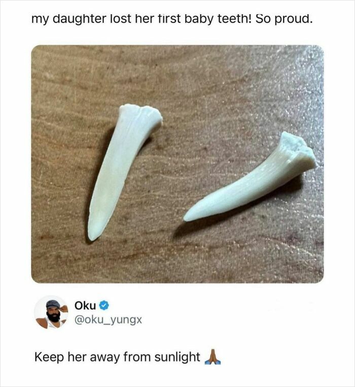 Close-up of two sharp white baby teeth lost by a daughter