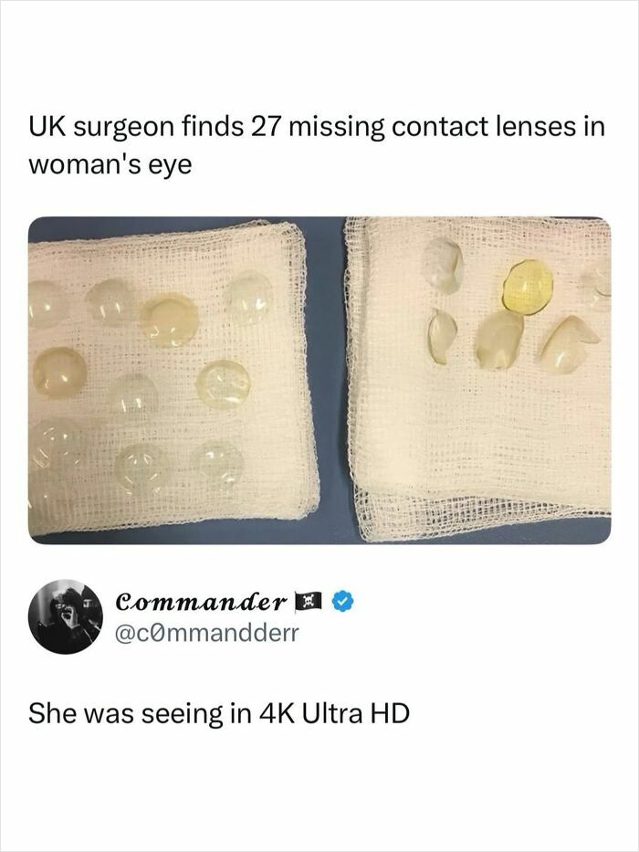 Twenty-seven contact lenses removed by UK surgeon joke in godless comments