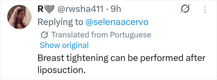 Nova foto de Selena Gomez revela cirurgia plástica surpreendente, afirmam fãs