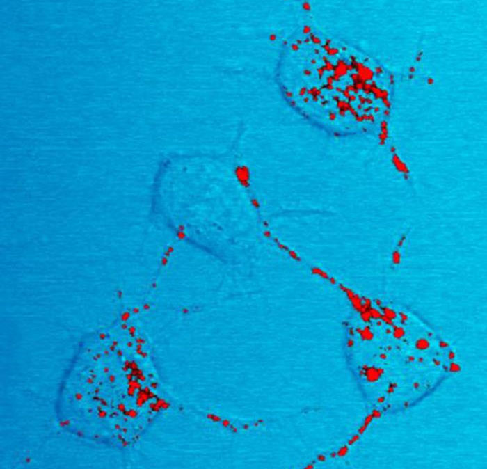 Microscopic cells with red markers illustrating anxiety-inducing biological factors