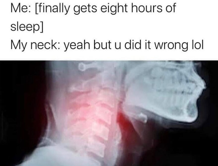 Funny meme about neck pain after eight hours of sleep with neck x-ray