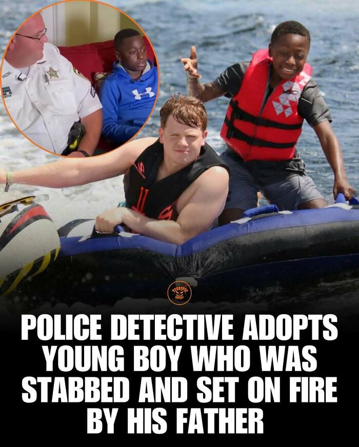 Police detective adopts boy stabbed and set on fire by his father
