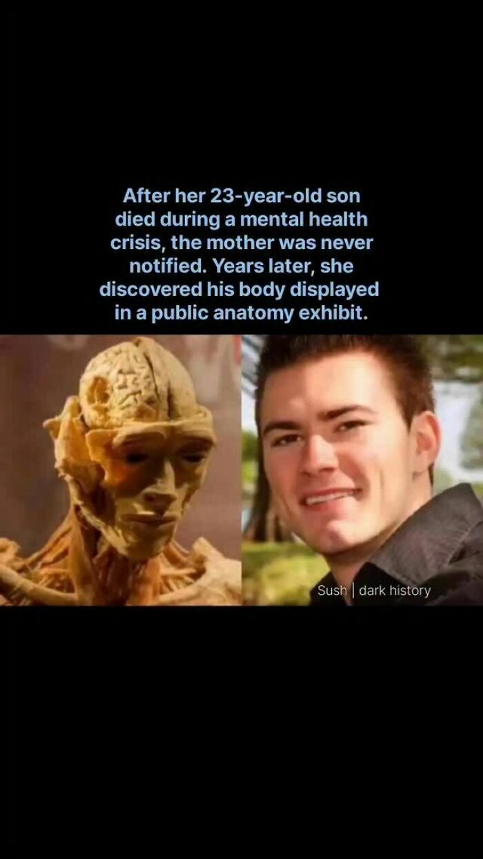 Man's body displayed in public anatomy exhibit without mother's knowledge, dark history fact