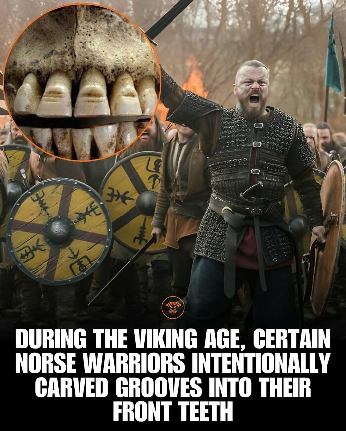 Viking Age Norse warriors carved grooves into their front teeth as a historic practice
