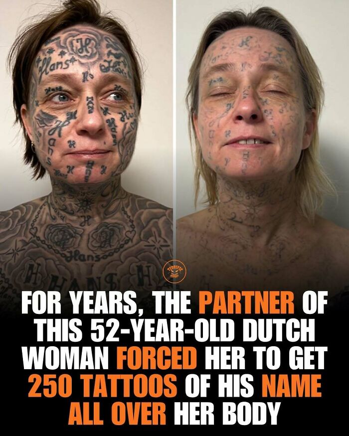Dutch woman forced to get 250 tattoos of partner's name all over her body