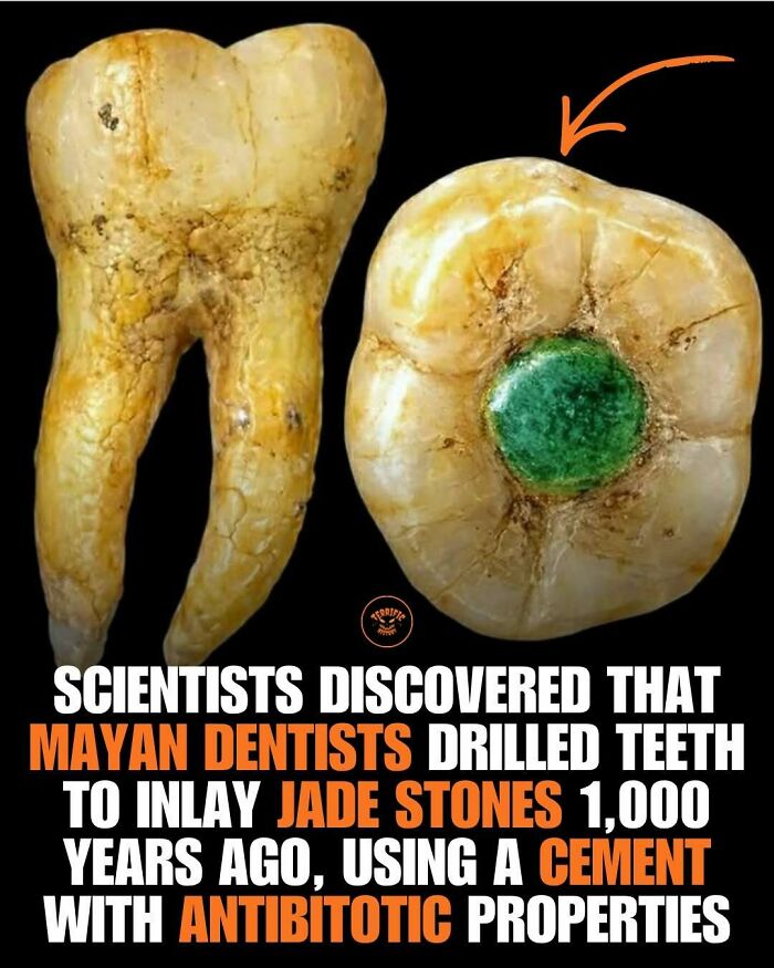 Scientists found Mayan dentists drilled teeth to inlay jade stones with antibiotic cement