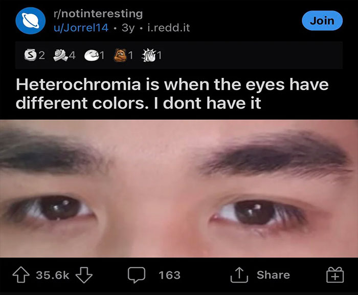 Reddit post about heterochromia with close-up of brown eyes