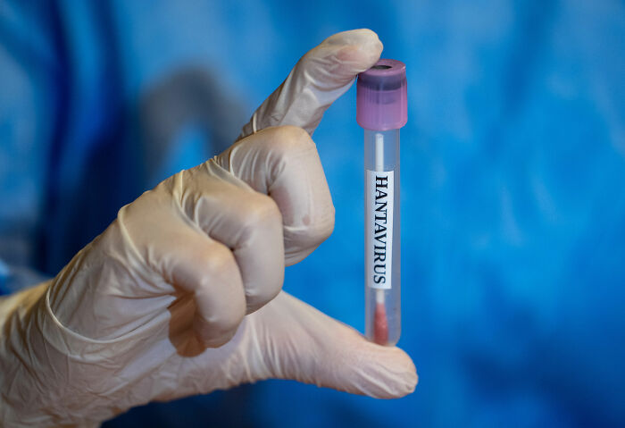 Hantavirus Panic Hits US As Returned Cruise Passengers Now Being Monitored Amid Confirmed Infections In Europe