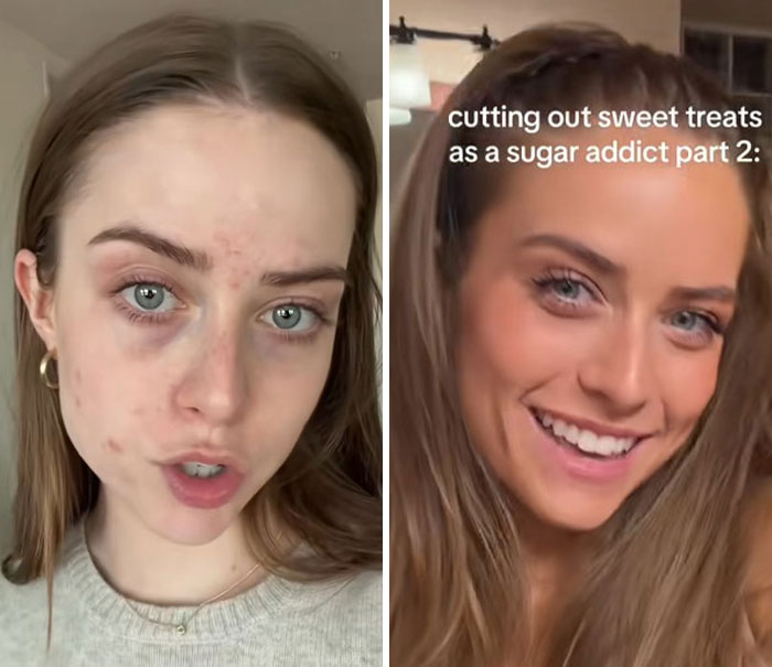 "Sugar Obsessed" Influencer Reveals Her Impressive Transformation After Cutting Out Sweets For Just Two Weeks