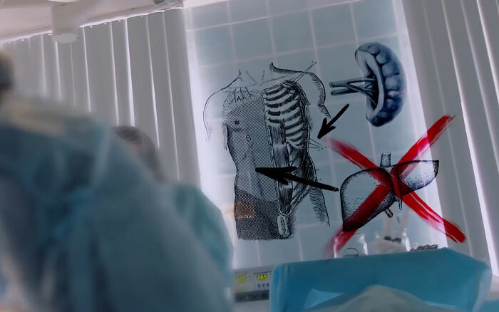 Cirurgião tem desculpa bizarra para remover fatalmente o órgão errado do paciente