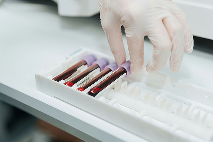 University College London Study Faces Scrutiny After Claiming Arts Lovers May Be Biologically A Year Younger Than Others University College London Study Faces Scrutiny After Claiming Arts Lovers May Be Biologically A Year Younger Than Others