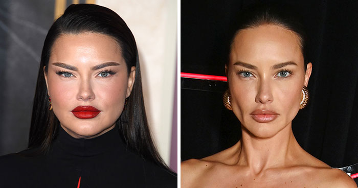 “Lost Another Baddie To Buccal Fat Removal”: 28 Celebrity Collages That Put Rumored Plastic Surgery On Display