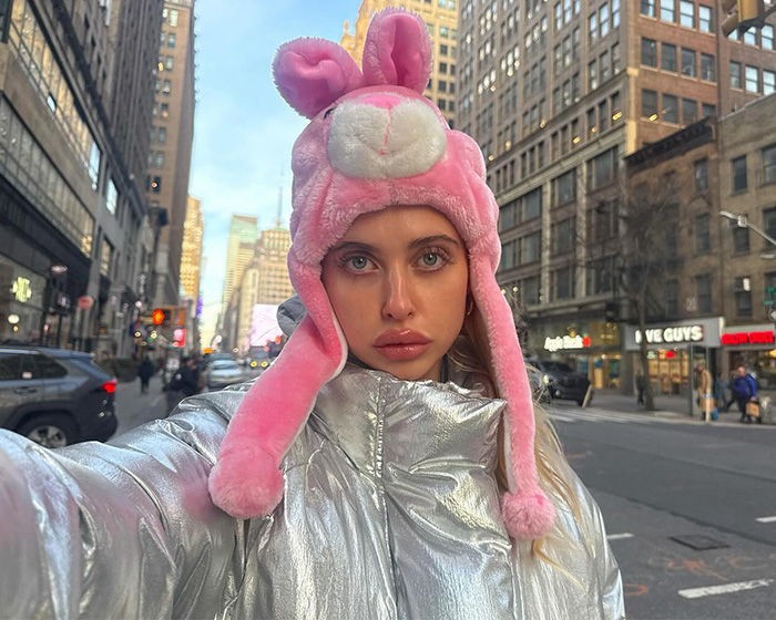Woman wearing pink bunny hat and silver jacket showcasing lip filler results