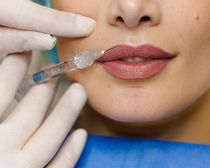 Medical professional injecting lip filler in close up
