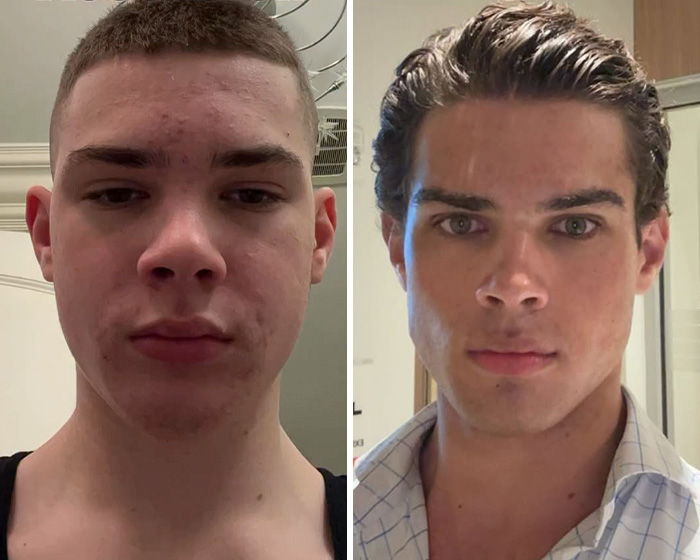 Experts Issue Urgent Warnings About "Hardmaxxing" As Dangerous Trend Grows Among Young Men