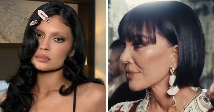 Met Gala 2026 Was More About Plastic Surgery Than Fashion As Stars Showed Off Their Procedures