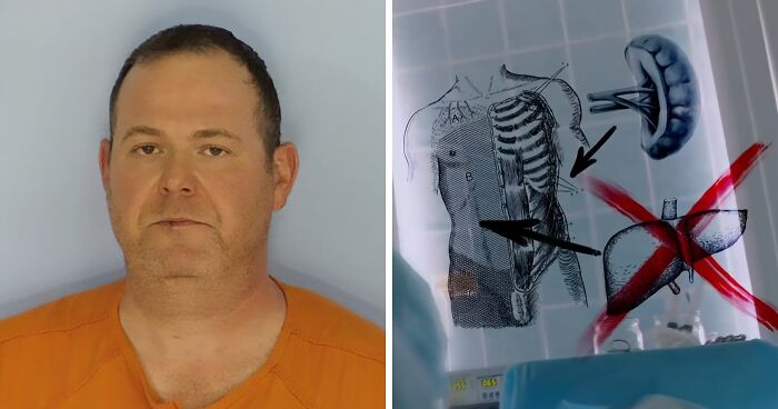 Surgeon Has Bizarre Excuse For Fatally Removing The Wrong Organ From Patient