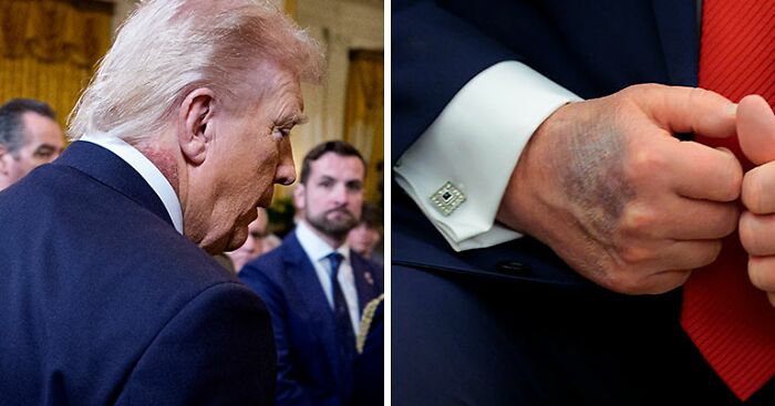 Ex‑White House Doctors Sound Alarm As President Trump Returns To Hospital For Third Time In 13 Months