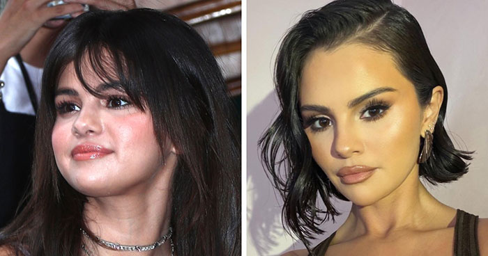 After Met Gala Frenzy Over Celebrity Bodies, Doctor Gives Verdict On The De‑Bloating Treatment Stars Get