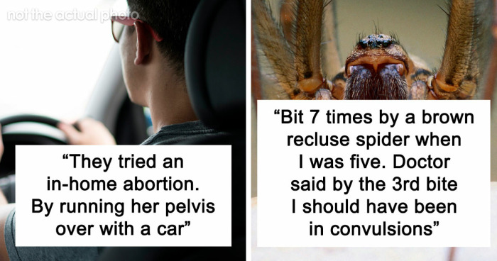 47 Times Doctors Wanted To Ask Their Patients “How The Hell Are You Even Alive Right Now?”