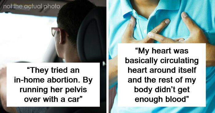 47 Times Doctors Wanted To Ask Their Patients “How The Hell Are You Even Alive Right Now?”