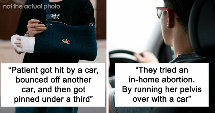 47 Times Doctors Wanted To Ask Their Patients “How The Hell Are You Even Alive Right Now?”