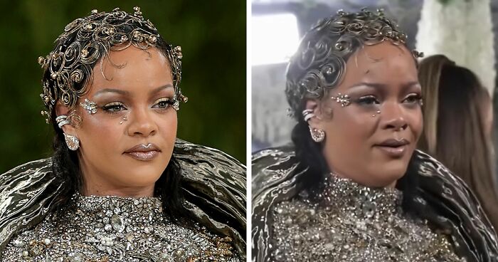 Met Gala 2026 Was More About Plastic Surgery Than Fashion As Stars Showed Off Their Procedures