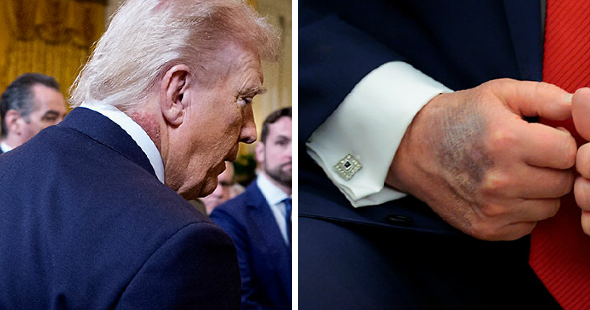 Ex‑White House Doctors Sound Alarm As President Trump Returns To Hospital For Third Time In 13 Months