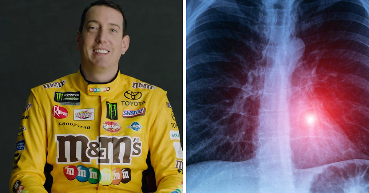 Doctors Reveal Dangers Of Life-Threatening Condition That Led To NASCAR Star Kyle Busch’s Sudden Passing At 41
