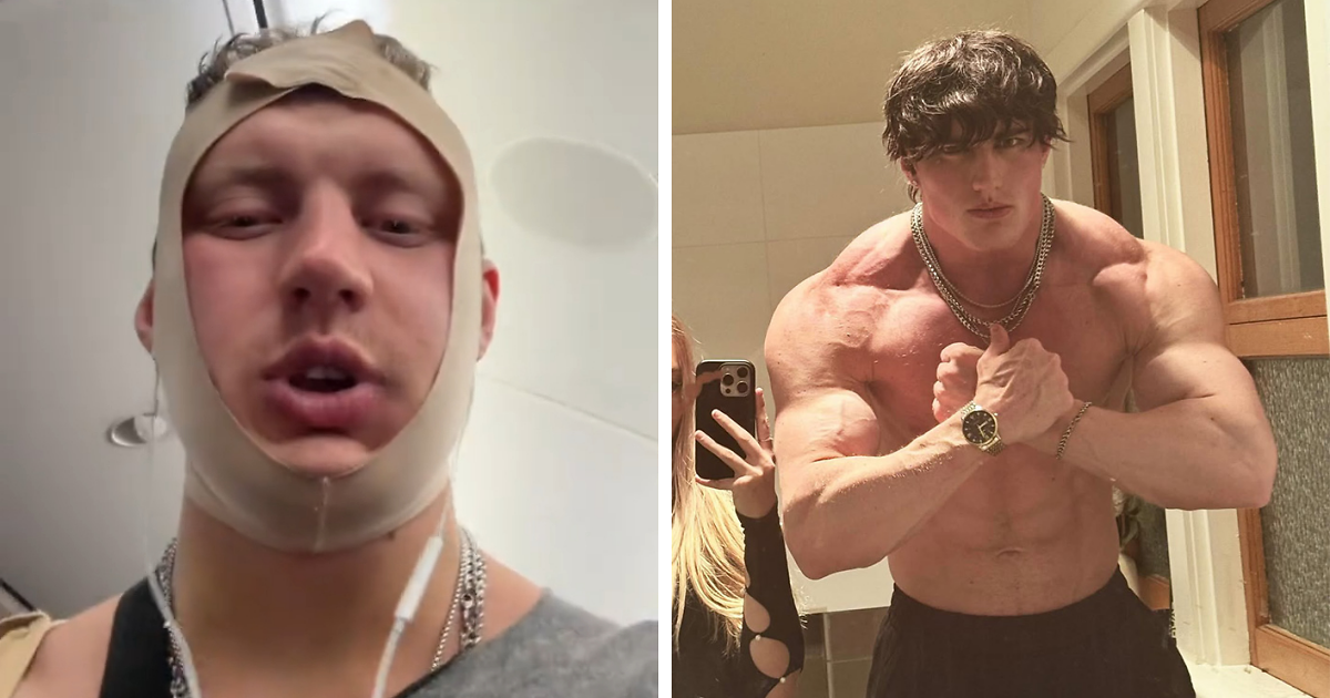 Looksmaxxer Androgenic Fights Flight Attendant And Gets Kicked Off Plane Shortly After Getting Plastic Surgery