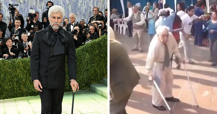Met Gala 2026 Was More About Plastic Surgery Than Fashion As Stars Showed Off Their Procedures