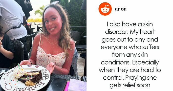 Teen With An Extremely Rare Skin Condition Talks About Her Struggles Online, Ends Up Going Viral
