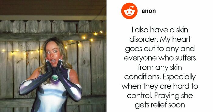 Teen With An Extremely Rare Skin Condition Talks About Her Struggles Online, Ends Up Going Viral