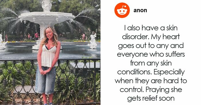 Teen With An Extremely Rare Skin Condition Talks About Her Struggles Online, Ends Up Going Viral