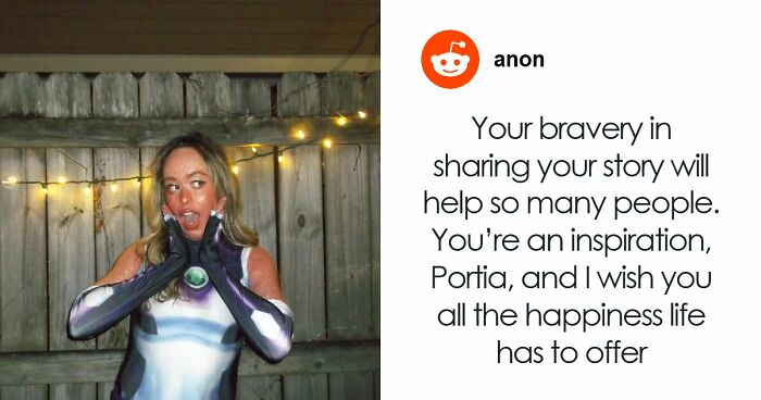Teen With An Extremely Rare Skin Condition Talks About Her Struggles Online, Ends Up Going Viral