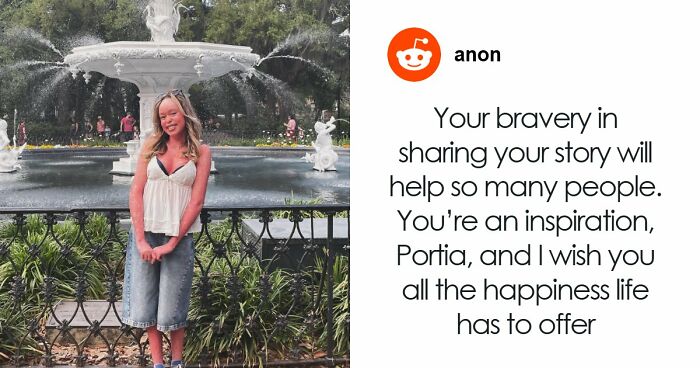 Teen With An Extremely Rare Skin Condition Talks About Her Struggles Online, Ends Up Going Viral