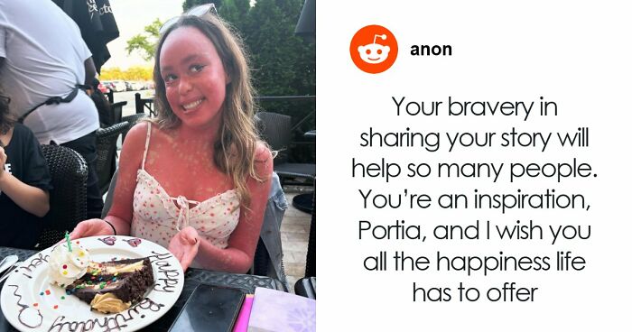 Teen With An Extremely Rare Skin Condition Talks About Her Struggles Online, Ends Up Going Viral