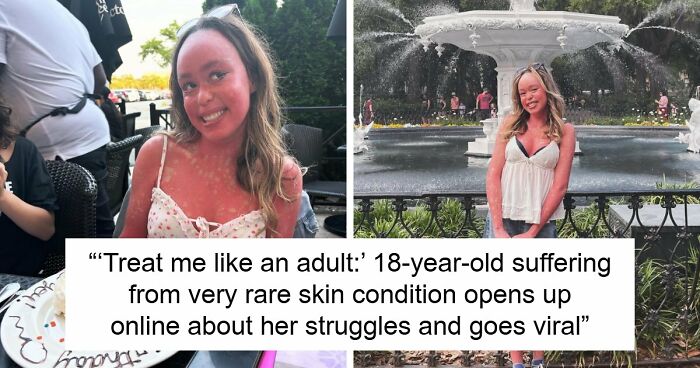 Teen With An Extremely Rare Skin Condition Talks About Her Struggles Online, Ends Up Going Viral
