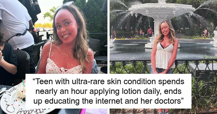 Teen With An Extremely Rare Skin Condition Talks About Her Struggles Online, Ends Up Going Viral