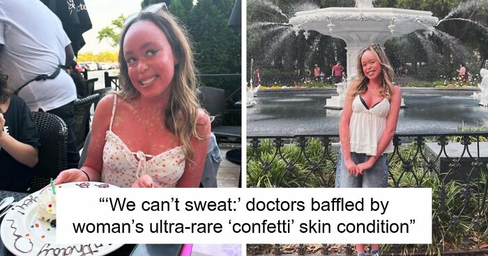 Teen With An Extremely Rare Skin Condition Talks About Her Struggles Online, Ends Up Going Viral